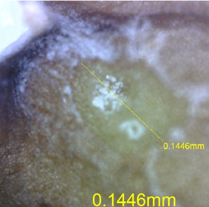 Laser microchannel in seed coat - 144.6 µm